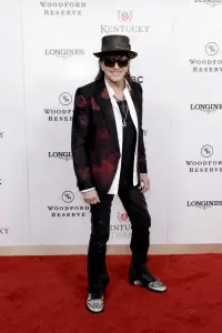 Richie Sambora fractures hand, forced to undergo surgery: ‘So much pain’